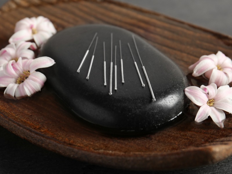 Acupuncture: Based in Traditional Chinese Medicine